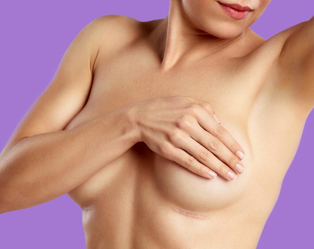 woman with small breast lift scar