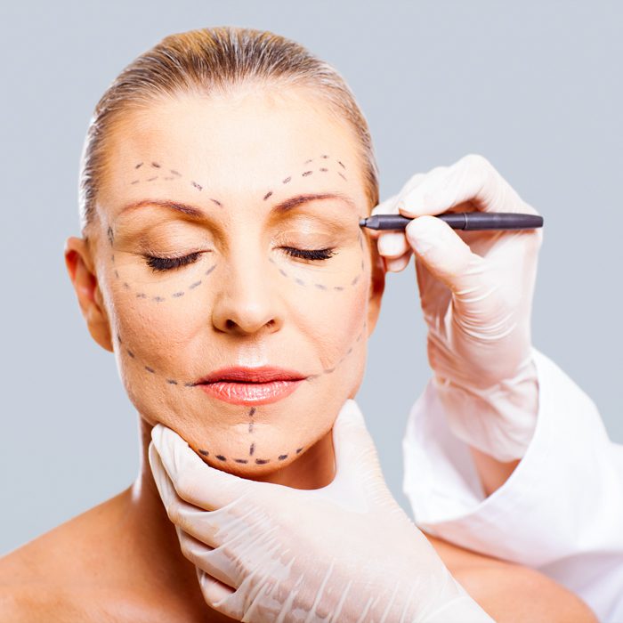 drawing surgical lines for reconstructive facial surgery